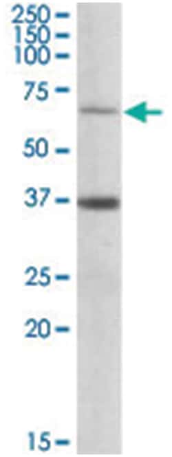 CPT2 Goat anti-Human, Polyclonal Antibody, Abnova 100&mu;g; Unlabeled:Antibodies,