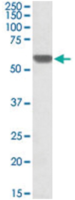 GPI Goat anti-Human, Polyclonal Antibody, Abnova 100 &mu;g | Buy Online | Abnova | Fisher Scientific