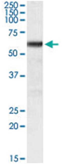 GPI Goat anti-Human, Polyclonal Antibody, Abnova 100&mu;g; Unlabeled:Antibodies,