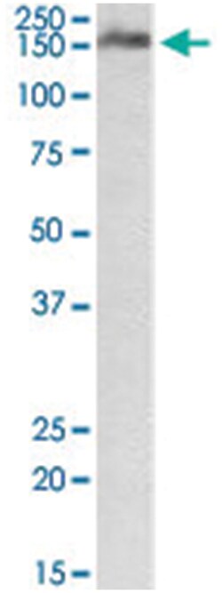 CSMD1, Goat, Polyclonal Antibody, Abnova 100&mu;g; Unlabeled:Antibodies,