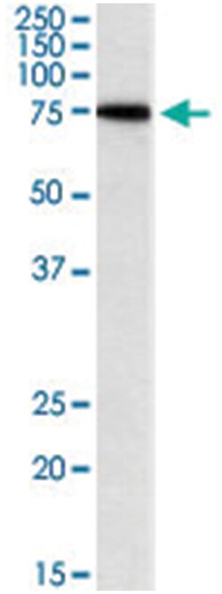 SNX1, Goat, Polyclonal Antibody, Abnova 100&mu;g; Unlabeled:Antibodies,