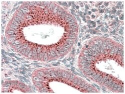 SNX1, Goat, Polyclonal Antibody, Abnova 100&mu;g; Unlabeled:Antibodies,