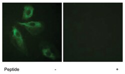 ADD1 Rabbit anti-Human, Mouse, Rat, Polyclonal Antibody, Abnova 100&mu;g;