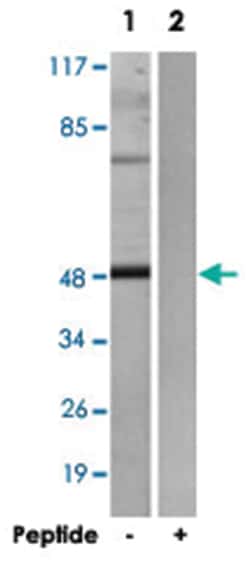 ADRB2 Rabbit anti-Human, Polyclonal Antibody, Abnova 100&mu;g; Unlabeled:Antibodies,