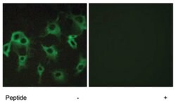 ADRB2 Rabbit anti-Human, Polyclonal Antibody, Abnova 100&mu;g; Unlabeled:Antibodies,