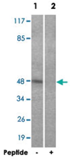 ADRB2 Rabbit anti-Human, Mouse, Polyclonal Antibody, Abnova 100&mu;g; Unlabeled:Antibodies,