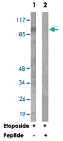 ACAN Rabbit anti-Human, Rat, Polyclonal Antibody, Abnova 100&mu;g; Unlabeled:Antibodies,