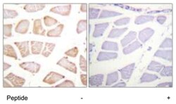 AKT1 Rabbit anti-Human, Mouse, Rat, Polyclonal Antibody, Abnova 100 &mu;g | Buy Online | Abnova | Fisher Scientific