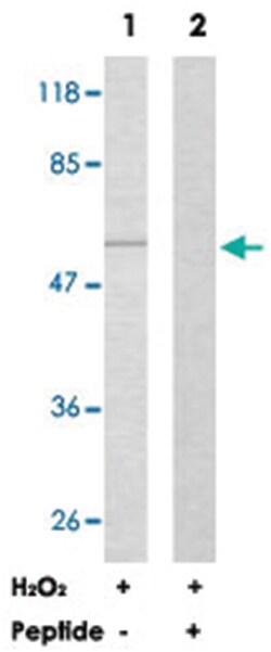 AKT1 Rabbit anti-Human, Mouse, Rat, Polyclonal Antibody, Abnova 100 &mu;g | Buy Online | Abnova | Fisher Scientific
