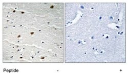 AKT1 Rabbit anti-Human, Mouse, Rat, Polyclonal Antibody, Abnova 100 &mu;g | Buy Online | Abnova | Fisher Scientific