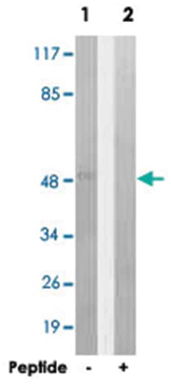 ALDH3B1, Rabbit, Polyclonal Antibody, Abnova 100&mu;g; Unlabeled:Antibodies,