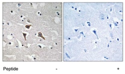 ALK Rabbit anti-Human, Mouse, Polyclonal Antibody, Abnova 100&mu;g; Unlabeled:Antibodies,