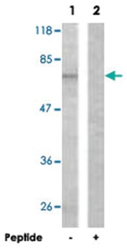 ALOX5 Rabbit anti-Human, Mouse, Rat, Polyclonal Antibody, Abnova 100 &mu;g | Buy Online | Abnova | Fisher Scientific