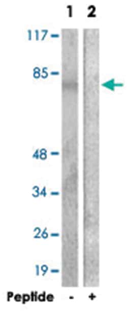 ANXA6 Rabbit anti-Human, Polyclonal Antibody, Abnova 100&mu;g; Unlabeled:Antibodies,