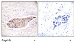 ANXA6 Rabbit anti-Human, Polyclonal Antibody, Abnova 100&mu;g; Unlabeled:Antibodies,