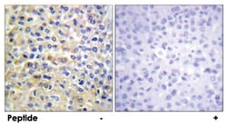 EGFR Rabbit anti-Human, Mouse, Rat, Polyclonal Antibody, Abnova 100&mu;g;