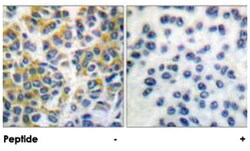 PTPN6 Rabbit anti-Human, Mouse, Rat, Polyclonal Antibody, Abnova 100&mu;g;