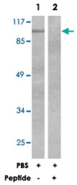 NTRK2 Rabbit anti-Human, Mouse, Rat, Polyclonal Antibody, Abnova 100&mu;g;