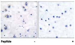 NTRK2 Rabbit anti-Human, Mouse, Rat, Polyclonal Antibody, Abnova 100&mu;g;