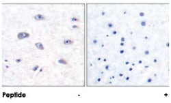 BACE1 Rabbit anti-Human, Mouse, Rat, Polyclonal Antibody, Abnova 100&mu;g;