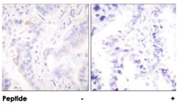 CRK Rabbit anti-Human, Mouse, Rat, Polyclonal Antibody, Abnova 100&mu;g;