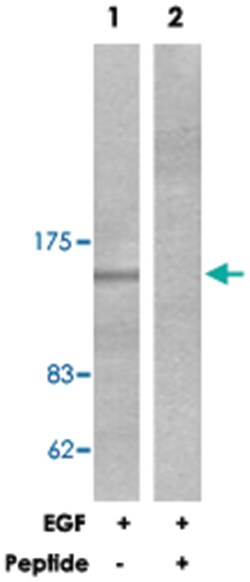 PLCG1 Rabbit anti-Human, Mouse, Rat, Polyclonal Antibody, Abnova 100&mu;g;