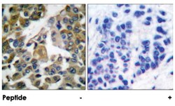 PLCG1 Rabbit anti-Human, Mouse, Rat, Polyclonal Antibody, Abnova 100&mu;g;
