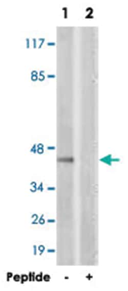 PRKAB1 Rabbit anti-Human, Mouse, Rat, Polyclonal Antibody, Abnova 100&mu;g;