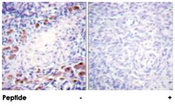 DAXX Rabbit anti-Human, Polyclonal Antibody, Abnova 100&mu;g; Unlabeled:Antibodies,