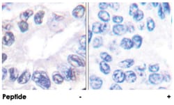 PRKDC Rabbit anti-Human, Polyclonal Antibody, Abnova 100&mu;g; Unlabeled:Antibodies,