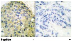 IKBKB Rabbit anti-Human, Mouse, Rat, Polyclonal Antibody, Abnova 100&mu;g;