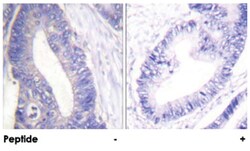 IRS1 Rabbit anti-Human, Mouse, Rat, Polyclonal Antibody, Abnova 100&mu;g;