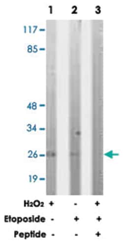BID Rabbit anti-Human, Mouse, Polyclonal Antibody, Abnova 100&mu;g; Unlabeled:Antibodies,