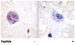 PTK2 Rabbit anti-Human, Mouse, Rat, Polyclonal Antibody, Abnova 100&mu;g;