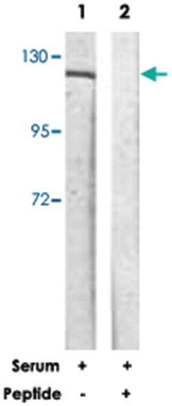 FGFR1 Rabbit anti-Human, Mouse, Rat, Polyclonal Antibody, Abnova 100 &mu;g | Buy Online | Abnova | Fisher Scientific