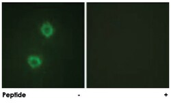 FGFR1 Rabbit anti-Human, Mouse, Rat, Polyclonal Antibody, Abnova 100 &mu;g | Buy Online | Abnova | Fisher Scientific