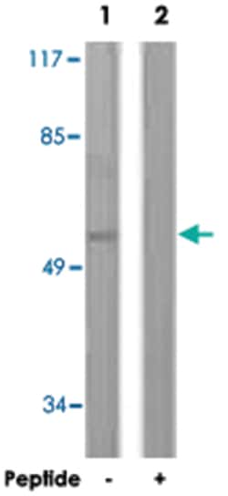 IRF3 Rabbit anti-Human, Polyclonal Antibody, Abnova 100&mu;g; Unlabeled:Antibodies,