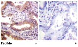 IRF3 Rabbit anti-Human, Polyclonal Antibody, Abnova 100&mu;g; Unlabeled:Antibodies,