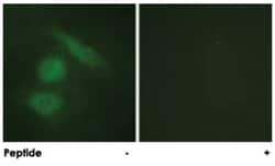 IRF3 Rabbit anti-Human, Polyclonal Antibody, Abnova 100&mu;g; Unlabeled:Antibodies,