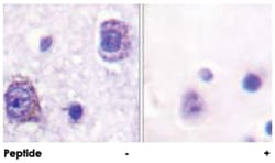 RPS6KB1 Rabbit anti-Human, Mouse, Rat, Polyclonal Antibody, Abnova 100&mu;g;