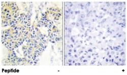 RPS6KB1 Rabbit anti-Human, Mouse, Rat, Polyclonal Antibody, Abnova 100&mu;g;