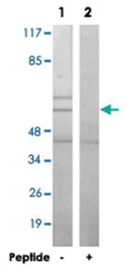 PAK1/PAK2/PAK3 Rabbit anti-Human, Mouse, Rat, Polyclonal Antibody, Abnova