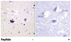 PAK1/PAK2/PAK3 Rabbit anti-Human, Mouse, Rat, Polyclonal Antibody, Abnova