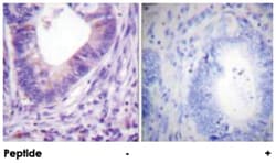 PRKACA Rabbit anti-Human, Mouse, Rat, Polyclonal Antibody, Abnova 100&mu;g;
