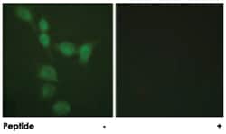 PRKACA Rabbit anti-Human, Mouse, Rat, Polyclonal Antibody, Abnova 100&mu;g;