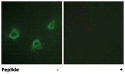 PLCG1 Rabbit anti-Human, Mouse, Rat, Polyclonal Antibody, Abnova 100&mu;g;