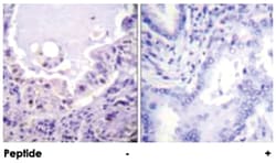 RAF1 Rabbit anti-Human, Mouse, Rat, Polyclonal Antibody, Abnova 100&mu;g;