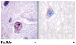 SF1 Rabbit anti-Human, Mouse, Polyclonal Antibody, Abnova 100&mu;g; Unlabeled:Antibodies,