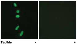 SF1 Rabbit anti-Human, Mouse, Polyclonal Antibody, Abnova 100&mu;g; Unlabeled:Antibodies,