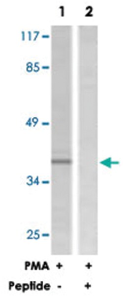 MAP2K1 Rabbit anti-Human, Mouse, Rat, Polyclonal Antibody, Abnova 100&mu;g;